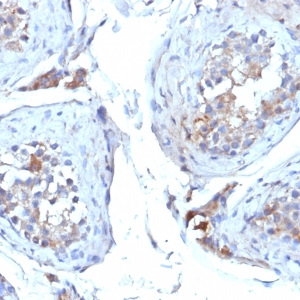 Sex Hormone Binding Globulin (SHBG); Clone SHBG/245 (Concentrate)